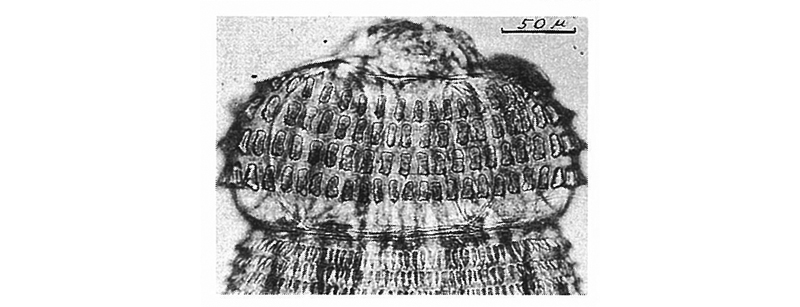 有棘顎口虫第3期幼虫の頭球
